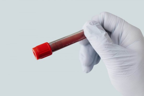 A gloved hand is holding a test tube containing a blood sample, capped with a red lid, against a plain light blue background, highlighting the importance of handling bloodborne pathogens with care.